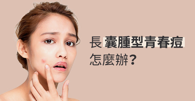長囊腫型痘痘怎麼辦? 囊腫型痘痘的成因和深層痘的治療方式