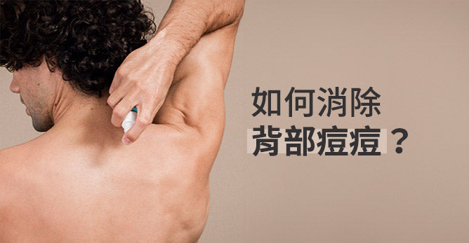 如何消除背部痘痘？四個步驟教您簡單脫離背痘
