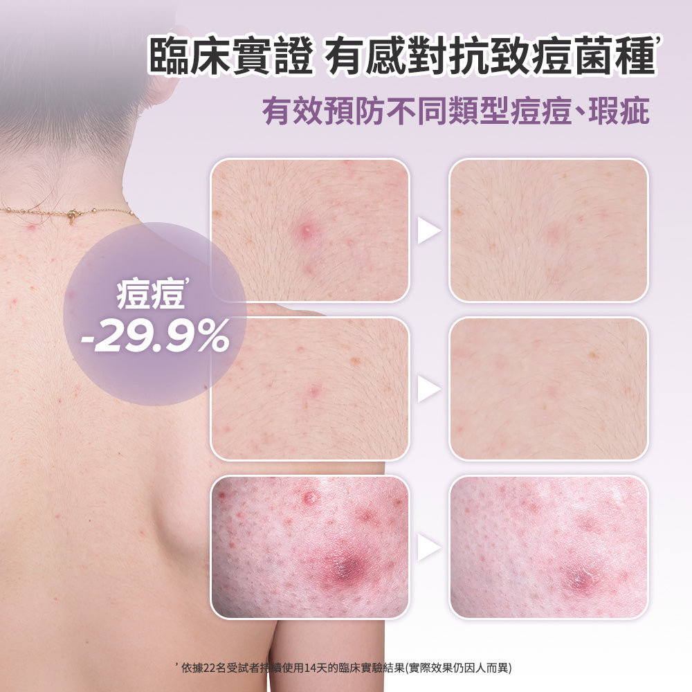 2%水楊酸身體乳