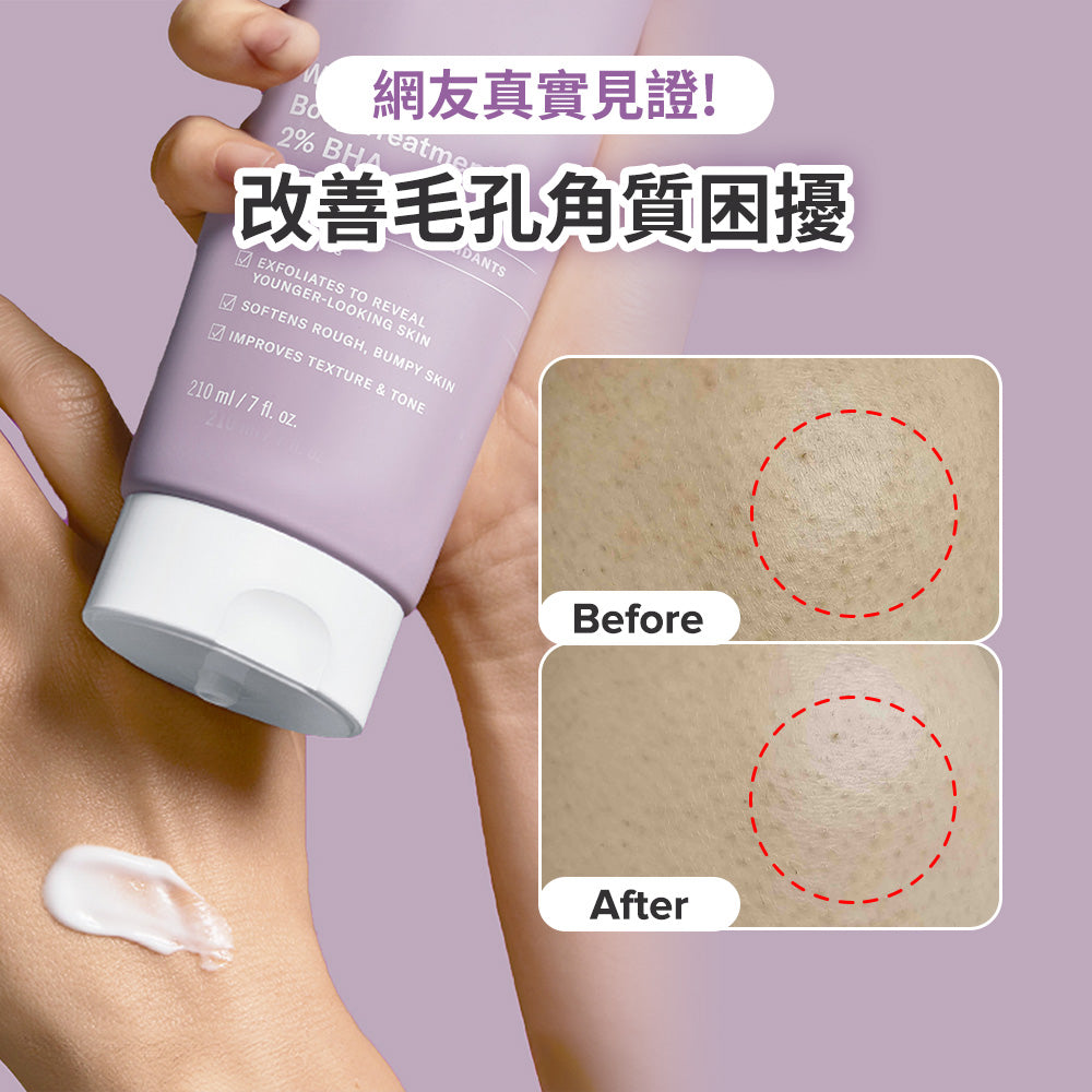 2%水楊酸身體乳