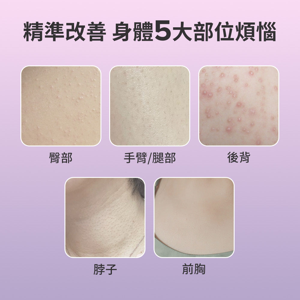 2%水楊酸身體乳【小包裝】