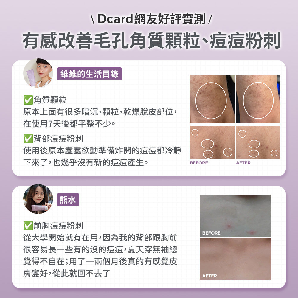 2%水楊酸身體乳【小包裝】