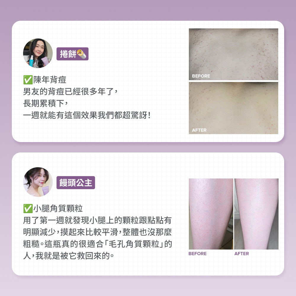 2%水楊酸身體乳【小包裝】