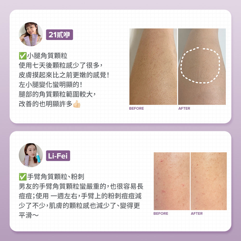 2%水楊酸身體乳【小包裝】
