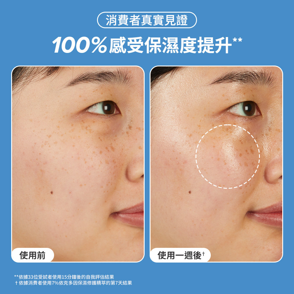 7%依克多因保濕修護精萃