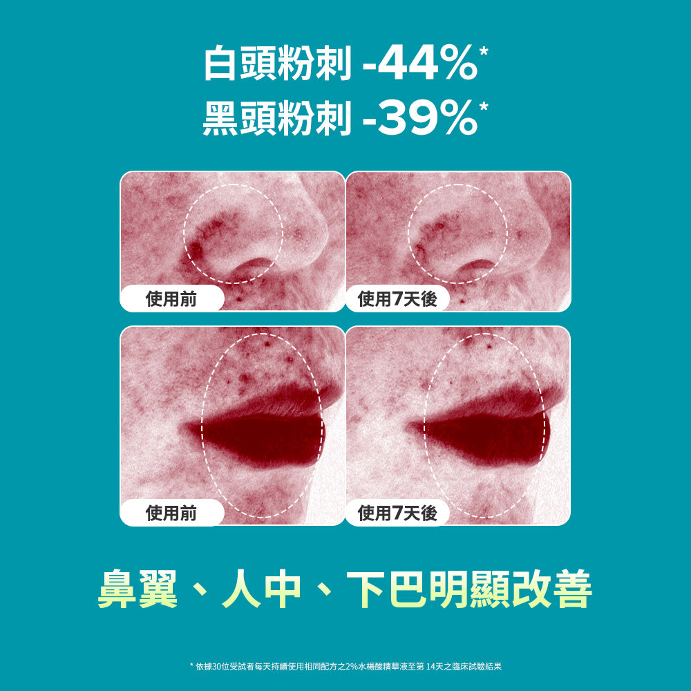 2%水楊酸精華去角質棉片