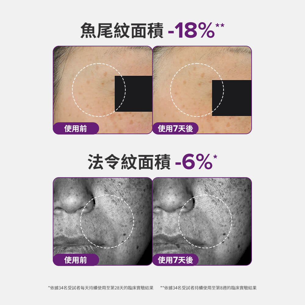 0.3%A醇+2%補骨脂酚精華乳