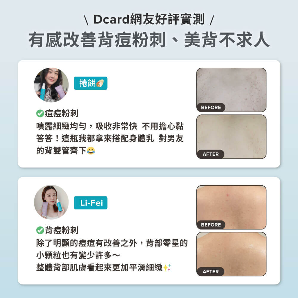淨無痘2%水楊酸美體噴露