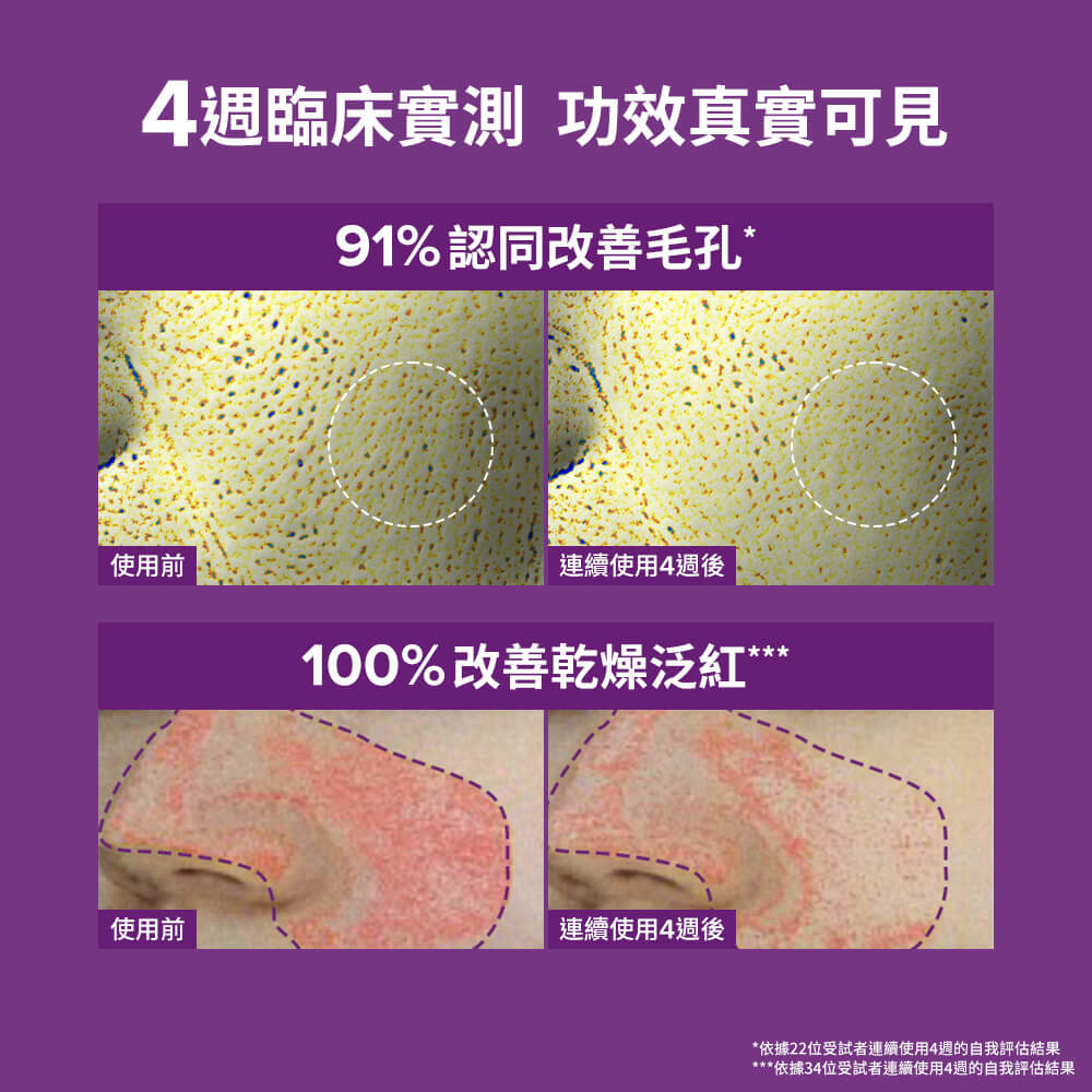 20%B3青春緊緻毛孔精華液