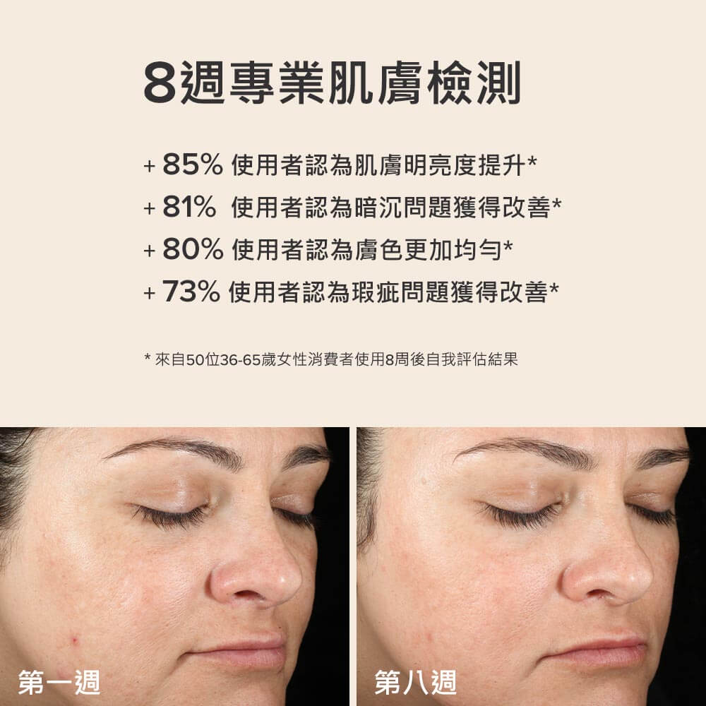 3%傳明酸淡斑喚白精華乳