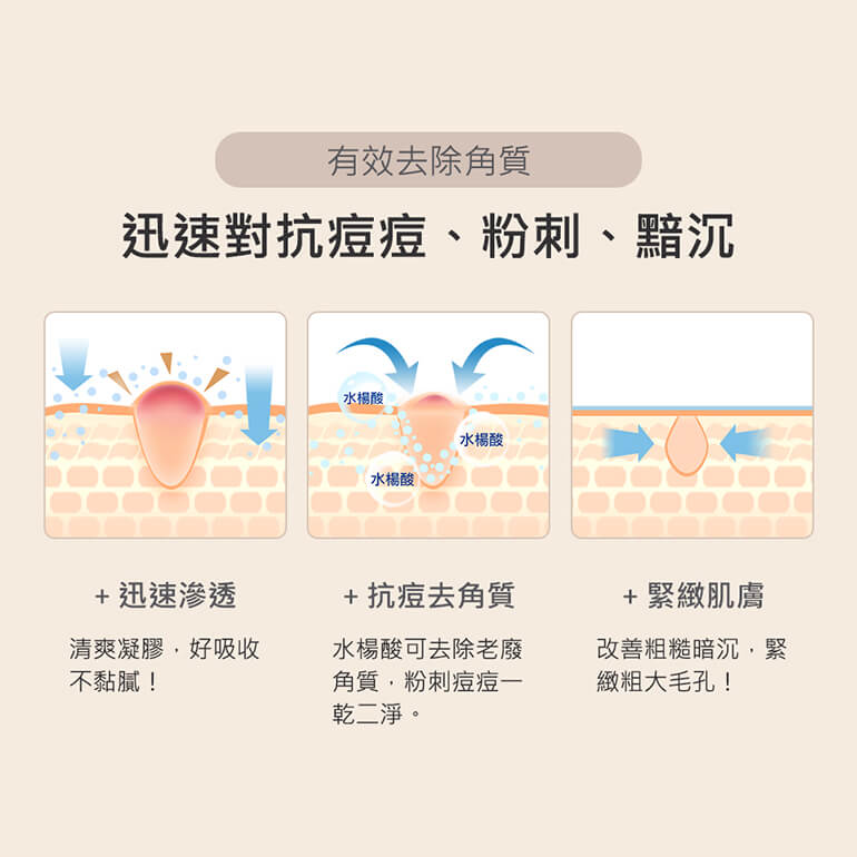 2%水楊酸凝膠