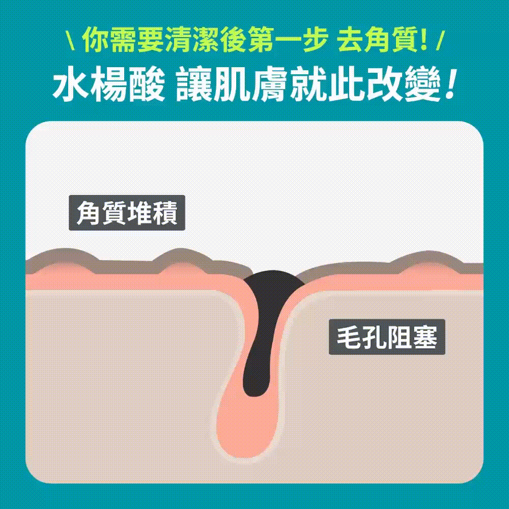 2%水楊酸精華液【小包裝】